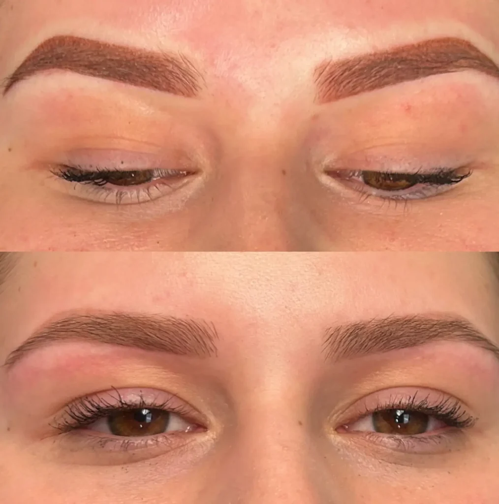 cosmetic tattooing