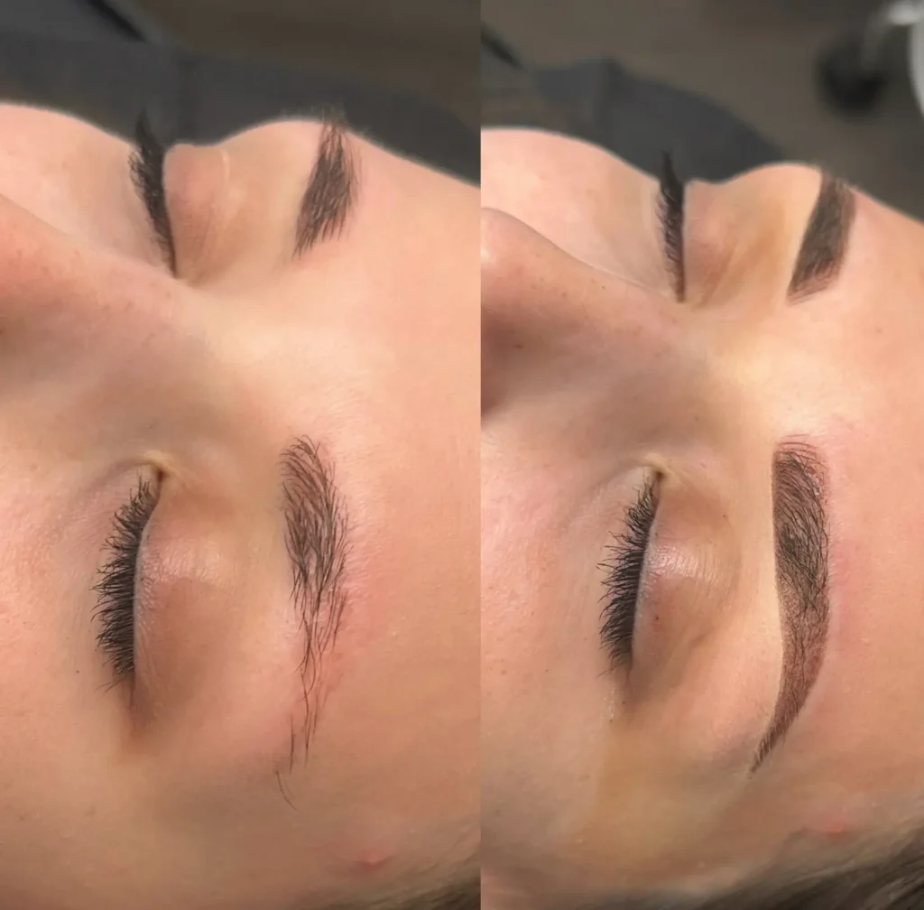 Will steroid cream ruin a cosmetic tattoo?