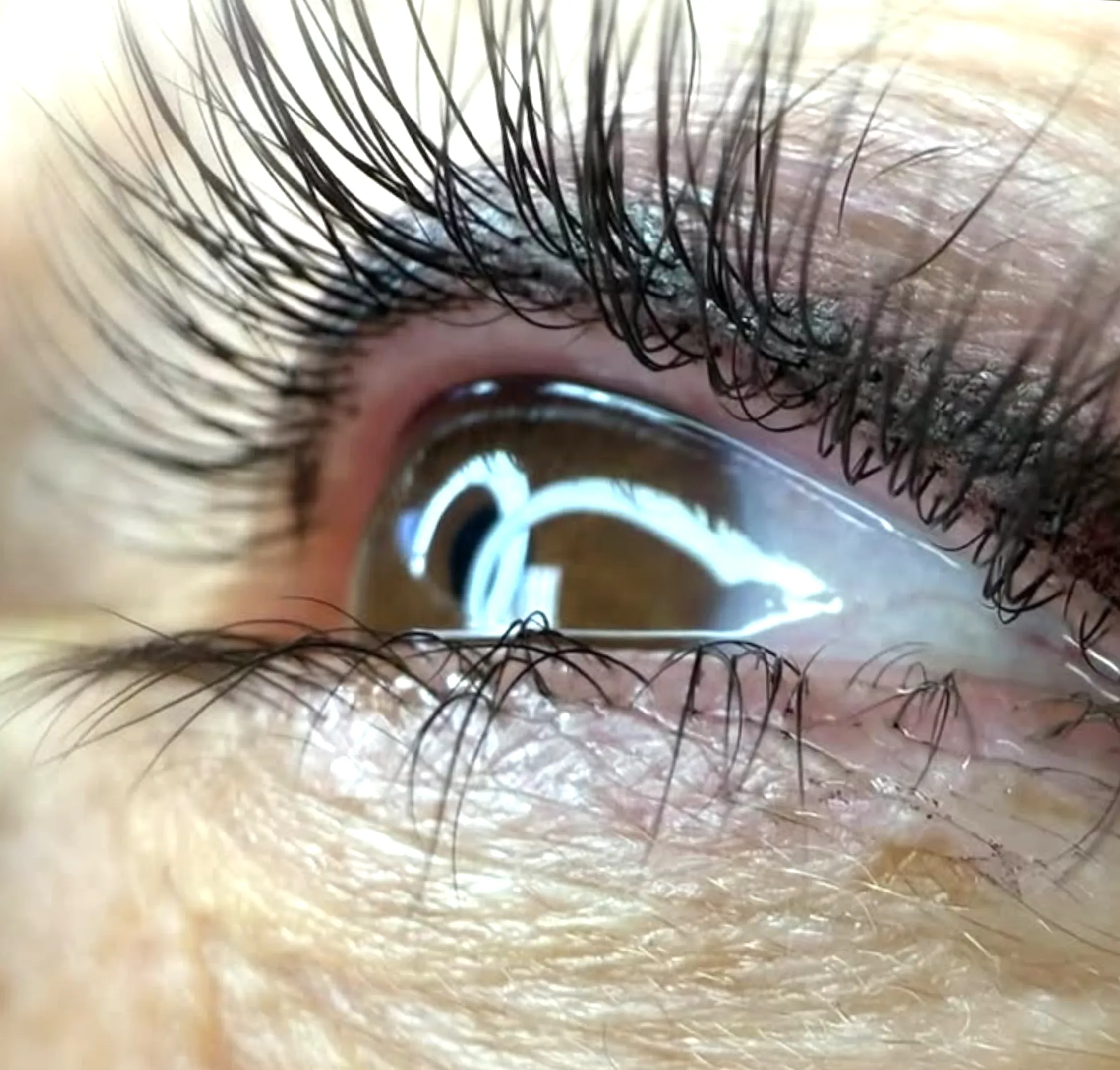 saline removal for eyeliner tattoo