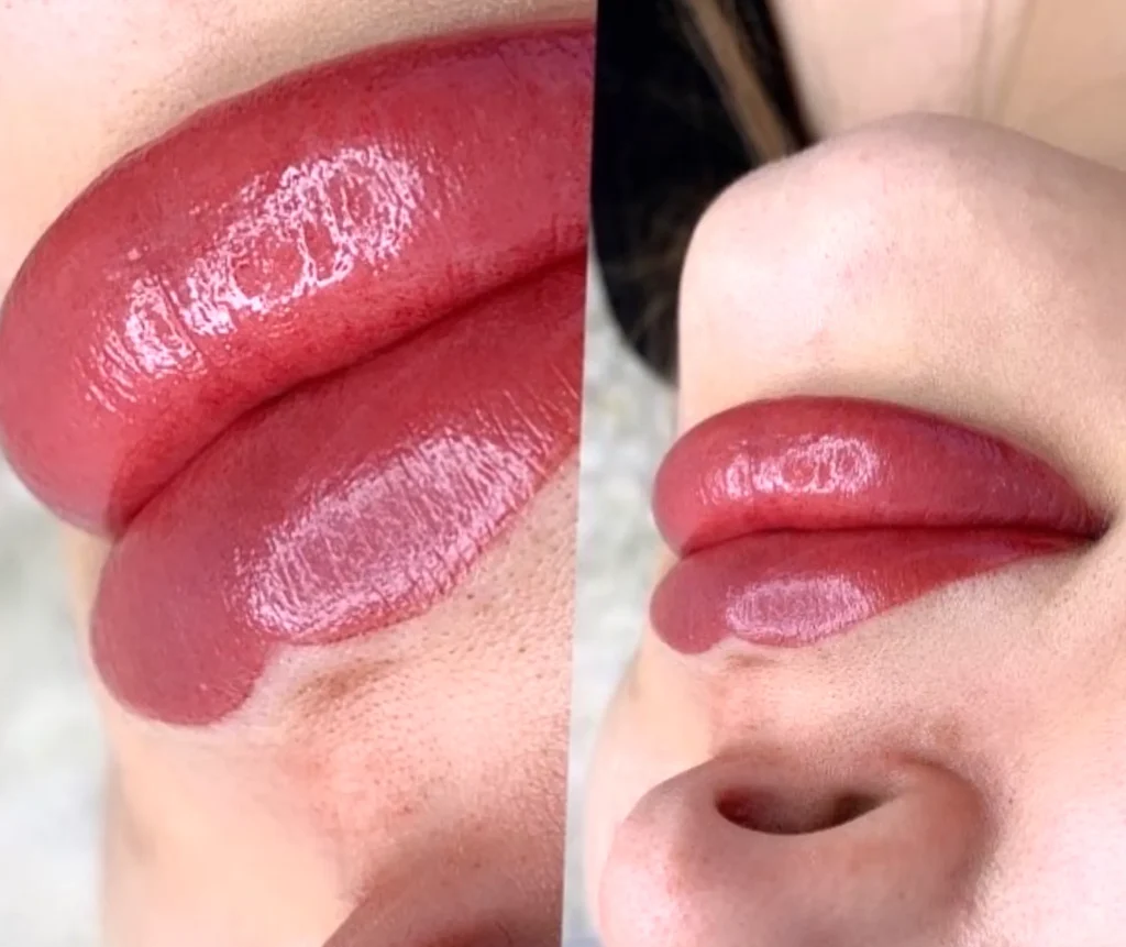 How Long Should I Use a Straw After Lip Blush?