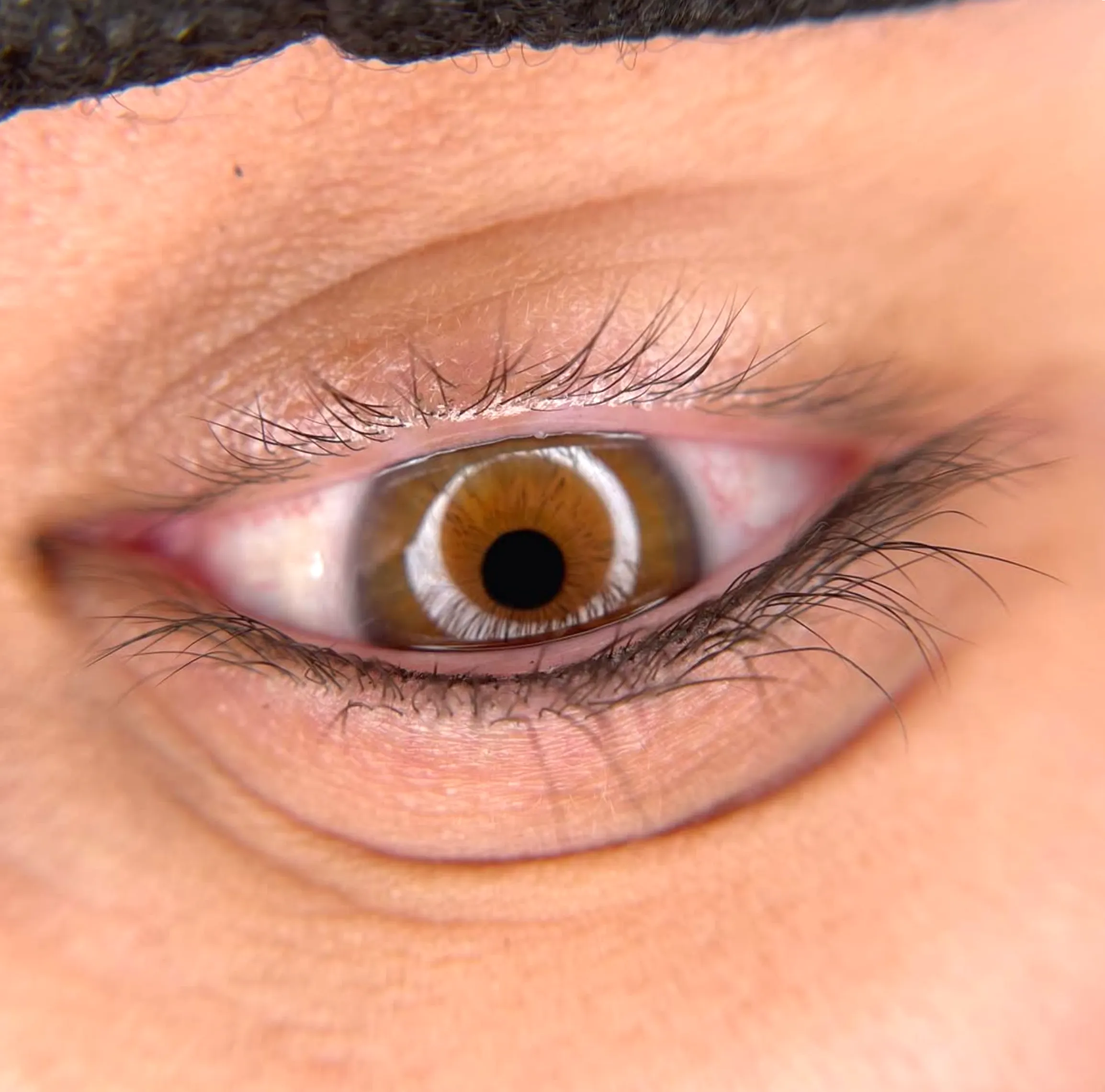 lash glue irritation